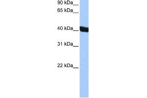 WB Suggested Anti-CHI3L1 Antibody Titration: 0. (CHI3L1 Antikörper  (Middle Region))