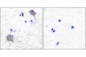 Immunohistochemistry analysis of paraffin-embedded human brain tissue, using Claudin 5 Antibody.