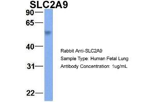 Host:  Rabbit  Target Name:  SLC2A9  Sample Type:  Human Fetal Lung  Antibody Dilution:  1.