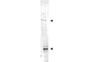 Western blot using  Affinity Purified anti-IDN3 antibody shows detection of bands at ~315 kDa and ~125 kDa corresponding to isoforms of IDN3 (arrow-heads) in mouse heart whole cell tissue extract.