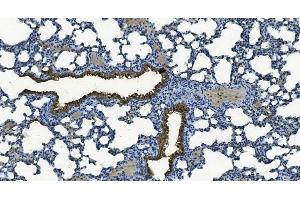 IHC analysis of MCU using anti-MCU antibody (ABIN7601931).