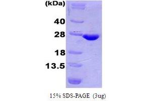 SDS-PAGE (SDS) image for Tumor Necrosis Factor (Ligand) Superfamily, Member 9 (TNFSF9) (AA 71-254) protein (His tag) (ABIN667100) (TNFSF9 Protein (AA 71-254) (His tag))