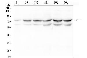 Western blot analysis of OLMF4 using anti-OLMF4 antibody (ABIN6719350).