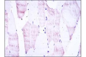 Immunohistochemistry (IHC) image for anti-Oligodendrocyte Lineage Transcription Factor 2 (OLIG2) antibody (ABIN969331)
