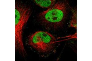 Immunofluorescent staining of U-251 MG with FOSL2 polyclonal antibody  (Green) shows positivity in nucleus but excluded from the nucleoli.