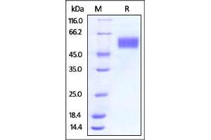 Vaccinia Virus B18R, His Tag on SDS-PAGE under reducing (R) condition.