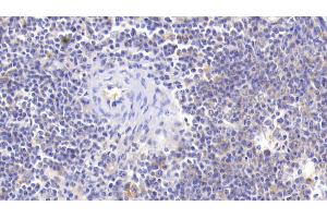 Immunohistochemistry (IHC) image for anti-Caspase 7, Apoptosis-Related Cysteine Peptidase (CASP7) (AA 24-198) antibody (ABIN7437974)