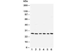 Western blot testing of ARC antibody and human samples 1:  SMMC-7721;  2: A549;  3: U87;  4: HeLa;  5: MCF-7;  6: rat liver (NOL3 Antikörper  (AA 91-106))