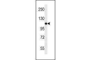 USO1 Antibody (C-term) (ABIN657956 and ABIN2846901) western blot analysis in ZR-75-1 cell line lysates (35 μg/lane). (USO1 Antikörper  (C-Term))