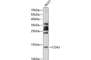 Western blot analysis of extracts of MCF7 cells, using CO antibody (ABIN7266633) at 1:1000 dilution. (CCDC56 Antikörper  (AA 1-106))