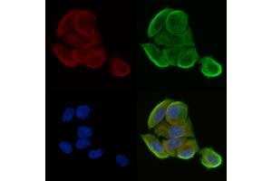 ABIN6265620 and ABIN6278644 staining Hela cells(30 min of UV treatment) by IF/ICC.