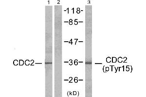 Western blot analysis of extracts from HepG2 cells, CDC2 (Ab-15) antibody (#Line 1 and 2) and CDC2 (phospho-Tyr15) antibody (Line 3). (CDK1 Antikörper  (pTyr15))