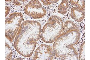 IHC-P Image Immunohistochemical analysis of paraffin-embedded human gastric tissue, using DIAPH1, antibody at 1:100 dilution. (DIAPH1 Antikörper  (N-Term))