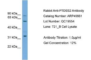 WB Suggested Anti-PTDSS2  Antibody Titration: 0.