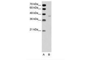 Image no. 2 for anti-Pannexin 1 (PANX1) (AA 231-280) antibody (ABIN6736329) (PANX1 Antikörper  (AA 231-280))
