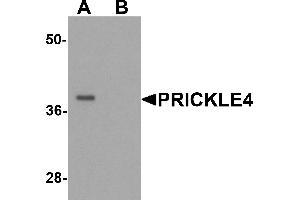 Western Blotting (WB) image for anti-Prickle Homolog 4 (PRICKLE4) (N-Term) antibody (ABIN1077371) (PRICKLE4 Antikörper  (N-Term))