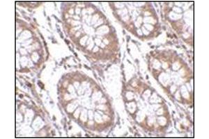 Immunohistochemistry of PTK7 in human colon tissue with this product at 2.