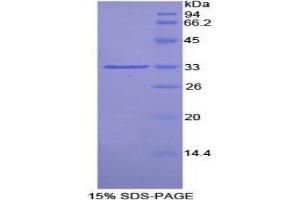 SDS-PAGE (SDS) image for Proto-Oncogene Pim-2 (Serine Threonine Kinase) (PIM2) (AA 34-292) protein (His tag) (ABIN1877932) (PIM2 Protein (AA 34-292) (His tag))