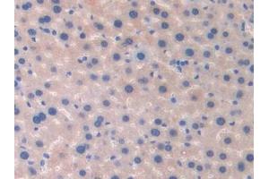Immunohistochemistry (IHC) image for anti-Fibulin 4 (FBLN4) (AA 182-431) antibody (ABIN7437848)