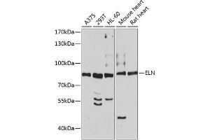 Western blot analysis of extracts of various cell lines, using ELN antibody (ABIN3016530, ABIN3016531, ABIN3016532 and ABIN6219774) at 1:1195 dilution. (Elastin Antikörper  (AA 27-200))