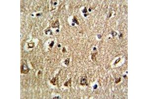 IHC analysis of FFPE human brain tissue stained with RAN antibody (RAN Antikörper  (AA 12-39))