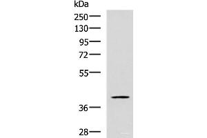Western blot analysis of TM4 cell lysate using RAB3IL1 Polyclonal Antibody at dilution of 1:600 (RAB3IL1 Antikörper)