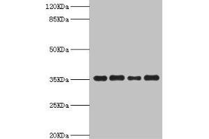 Western blot All lanes: PDXK antibody at 5. (PDXK Antikörper  (AA 1-312))