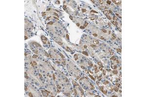 Immunohistochemical staining (Formalin-fixed paraffin-embedded sections) of human stomach using TAOK3 polyclonal antibody  shows strong cytoplasmic positivity in parietal cells. (TAO Kinase 3 Antikörper  (AA 323-432))