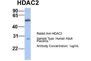 Host:  Rabbit  Target Name:  HDAC2  Sample Type:  Human Adult Placenta  Antibody Dilution:  1. (HDAC2 Antikörper  (Middle Region))