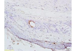 Immunohistochemistry (Paraffin-embedded Sections) (IHC (p)) image for anti-1-Acylglycerol-3-Phosphate O-Acyltransferase 4 (AGPAT4) (AA 231-330) antibody (ABIN708671)