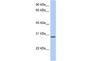 HAVCR2 antibody used at 1 ug/ml to detect target protein. (TIM3 Antikörper  (N-Term))