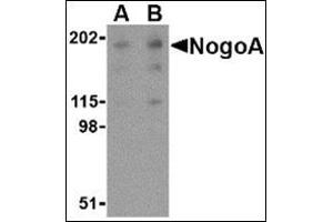 Western blot analysis of NogoA in human brain tissue lysate with this product at (A) 0.
