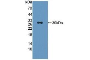 Detection of Recombinant LAG3, Rat using Polyclonal Antibody to Lymphocyte Activation Gene 3 (LAG3) (LAG3 Antikörper  (AA 209-451))
