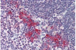 Human Thymus (formalin-fixed, paraffin-embedded) stained with DNASE2 antibody ABIN214485 at 5 ug/ml followed by biotinylated goat anti-rabbit IgG secondary antibody ABIN481713, alkaline phosphatase-streptavidin and chromogen. (DNASE2 Antikörper  (AA 347-360))