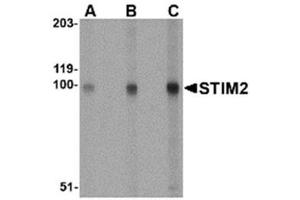 Image no. 1 for anti-Stromal Interaction Molecule 2 (Stim2) (Middle Region) antibody (ABIN318882) (Stim2 Antikörper  (Middle Region))