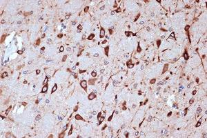 Immunohistochemistry (IHC) image for anti-Protein Kinase, Interferon-Inducible Double Stranded RNA Dependent Activator (PRKRA) antibody (ABIN7269666)