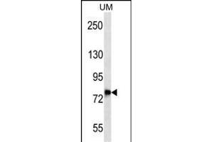 DNAJC14 Antibody (Center) (ABIN657070 and ABIN2846233) western blot analysis in uterus tumor cell line lysates (35 μg/lane). (DNAJC14 Antikörper  (AA 184-213))