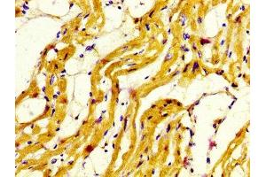 Immunohistochemistry (IHC) image for anti-Myosin Heavy Chain 7, Cardiac Muscle, beta (MYH7) (AA 1802-1915) antibody (ABIN7160588)