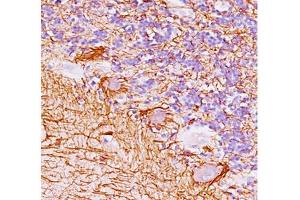 Human cerebellum stained with Neurofilament antibody (NF421). (Neurofilament Antikörper)
