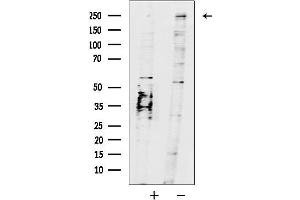 Western blot analysis of lysates from Hela cells, using MYS Antibody.