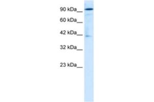 Western Blotting (WB) image for anti-OTU Domain Containing 7B (OTUD7B) antibody (ABIN2460998) (OTUD7B Antikörper)
