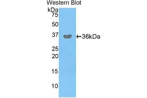 Detection of Recombinant PDHb, Human using Polyclonal Antibody to Pyruvate Dehydrogenase Beta (PDHb) (PDHB Antikörper  (AA 31-341))