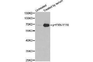 Western blot analysis of extracts from 3T3 cells, using phospho-PXN-Y118 antibody (ABIN2987461). (Paxillin Antikörper  (pTyr118))