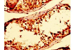 Immunohistochemistry (IHC) image for anti-Thioredoxin (TXN) (AA 2-105) antibody (ABIN7172014)