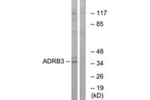 Western Blotting (WB) image for anti-Adrenergic, beta-3-, Receptor (ADRB3) (AA 250-299) antibody (ABIN2890752) (ADRB3 Antikörper  (AA 250-299))