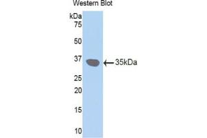 Western blot analysis of the recombinant protein. (Connexin 31 Antikörper  (AA 210-270))