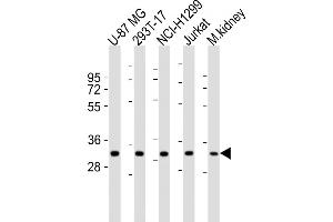 All lanes : Anti-FN3KRP Antibody (N-Term) at 1:1000-1:2000 dilution Lane 1: U-87 MG whole cell lysates Lane 2: 293T-17 whole cell lysates Lane 3: NCI- whole cell lysates Lane 4: Jurkat whole cell lysates Lane 5: mouse kidney lysates Lysates/proteins at 20 μg per lane.