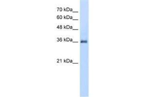 Western Blotting (WB) image for anti-Phosphatidic Acid Phosphatase Type 2A (PPAP2A) antibody (ABIN2462626) (PPAP2A Antikörper)