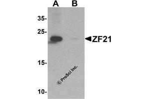 Western Blotting (WB) image for anti-Zinc Finger, FYVE Domain Containing 21 (ZFYVE21) (N-Term) antibody (ABIN1031675) (ZFYVE21 Antikörper  (N-Term))