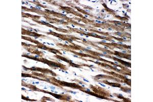 Anti-AIF antibody, IHC(P) IHC(P): Rat Cardiac Muscle Tissue (AIF Antikörper  (C-Term))